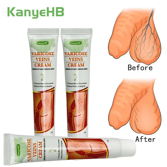 crèmes pour varices génitales Pack 2 Piéce B